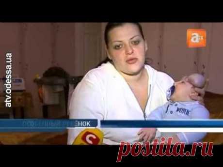 В  Одессе живёт единственный в мире малыш без черепа
