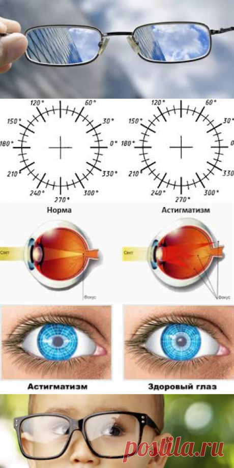 Вконтакте Евгений Слогодский восстановление зрения канал зоркое зрение здоровье компьютер упражнения гимнастика тренировка разминка зарядка йога для глаз массаж вокруг глаз видео лечение коррекция исправление зрения без операции избавиться от очков линз как восстановить вернуть улучшить плохое зрение симптомы причины рекомендации близорукость катаракта глаукома астигматизм дальнозоркость амблиопия миопия косоглазие острота зрения быстро снять усталость глаз от компьютера пальминг медитация