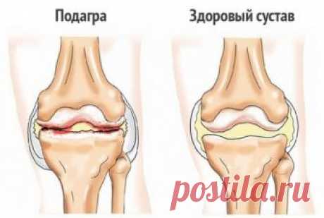 Отличный рецепт от боли в суставах 

Простейший народный рецепт для лечения суставов. 
(не смотрите, что простой, очень много отзывов об эффективности этого рецепта!) 

Наверняка многие не по наслышке знают, что такое боли в суставах. Какой, мягко скажем, дискомфорт доставляют они человеку. 
А народный рецепт лечения суставов необычайно прост, к тому же безопасен. 

1 ч. ложку пищевого желатина заливаем остывшей кипяченой водой (0,5 стакана) и оставляем на ночь. 

Утром до...