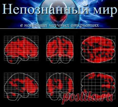 Медитация замедляет старение мозга | Непознанный мир

С помощью медитации может замедляться старение мозга, при котором уменьшается серое вещество головного мозга, сообщают исследователи из Университета Калифорнии