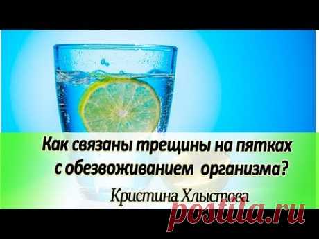 Почему важно много пить воды? Как связаны трещины на пятках с обезвоживанием организма?