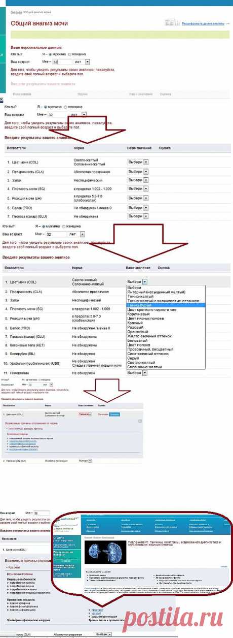 Как расшифровать анализ мочи?