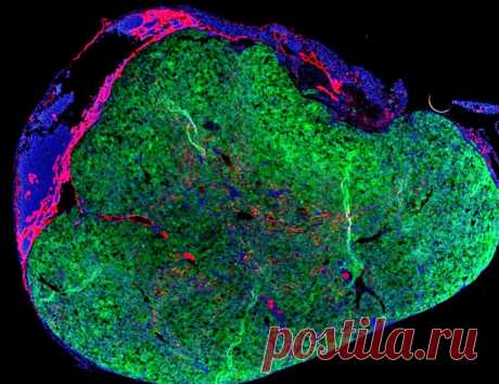 «Мини-печень» будет расти в собственном лимфатическом узле человека в новом смелом исследовании