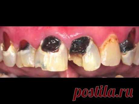 2013 Innovative Dental Before &amp; After Gallery