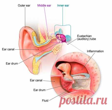 3 рецепта, которые избавят от боли в ухе / Будьте здоровы
