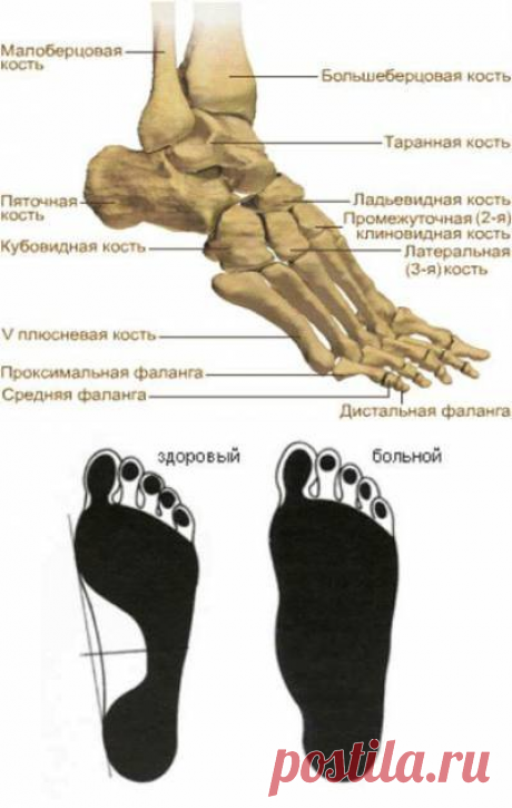 Болит стопа сверху очень больно ходить