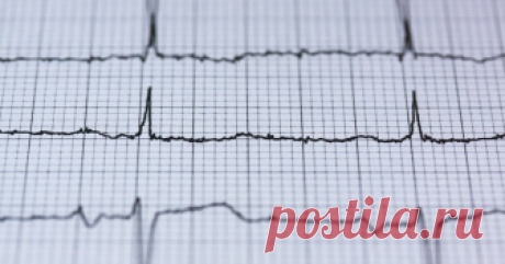 Новый метод покажет истинную причину боли в сердце Врачи смогут лучше диагностировать инфаркт.