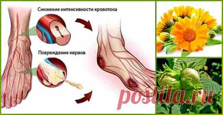 Что такое диабетическая нейропатия? Это заболевание связано с расстройством всех  нервов, относящихся к периферической нервной системе, отвечающих за чувствительность, вегетативные и двигательные функции.