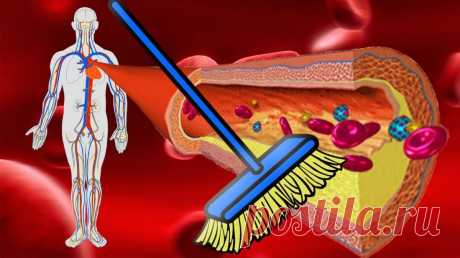 Врачи рассказали: как очистить сосуды без дорогостоящих препаратов | Голос Правды – Новости Красноармейского района