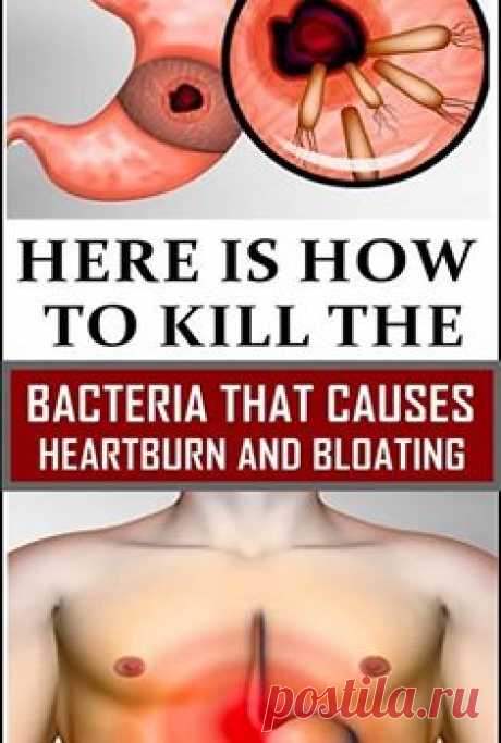 Here is How to Kill the Bacteria that Causes Heartburn and Bloating