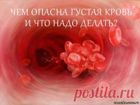 ЧЕМ ОПАСНА ГУСТАЯ КРОВЬ И ЧТО НАДО ДЕЛАТЬ? АЛЕКСЕЙ МАМАТОВ - ЗДОРОВЬЕ - КРАСОТА И ЗДОРОВЬЕ - Каталог статей - Персональный сайт