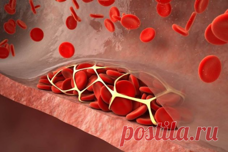 Долой тромбоз: продукты, которые эффективно разжижают кровь | Будни эндоморфа | Яндекс Дзен