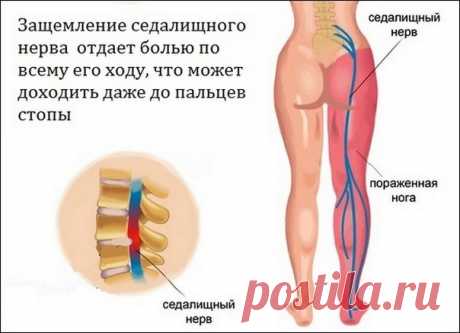 ЧТО ТАКОЕ ИШИАС ИЛИ ПОЧЕМУ СИЛЬНО ТЯНЕТ НОГУ ПРИ ХОДЬБЕ?
КАК ПРАВИЛО ЗАЩЕМЛЕНИЯ НЕРВА И ГРЫЖИ В ОБЛАСТИ ДИСКОВ L4-S1 ДАЕТ БОЛЬ В НОГЕ И ЕЕ ОНЕМЕНИЕ.
КОНСУЛЬТАЦИЯ ОПЫТНОГО МАНУАЛЬНОГО ТЕРАПЕВТА ПО ТЕЛ
+7-931-36--16-23