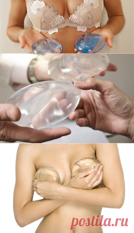 Как правильно выбрать грудные импланты