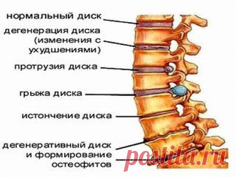 Жалобы при болях отдельных позвоночников и что это означает