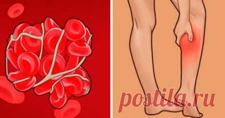 УЗНАЛ САМ - РАССКАЖИ ДРУГОМУ!: Признаки тромбов в кровеносных сосудах, и что делать, если вы их обнаружили