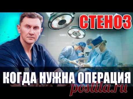 Операция при стенозе - все что нужно знать.Нейрохирург