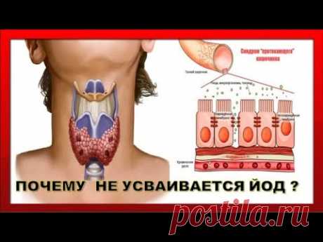 ЩИТОВИДКА будет РАБОТАТЬ КАК ЧАСЫ если.../ПОЧЕМУ НЕ УСВАИВАЕТСЯ ЙОД и нарушается работа ЩИТОВИДКИ