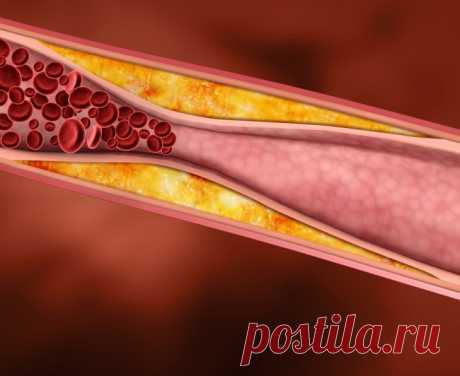 Как понизить уровень холестерина в организме — Мания.инфо