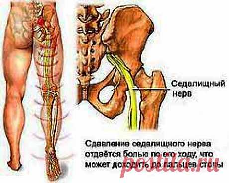 Межпозвоночная грыжа: Операция или Нет?

По мнению современных специалистов -ортопедов и неврологов работающих в области вертебрологии и кинезиотерапии, только 3 % людей, страдающих грыжей межпозвонкового диска нуждаются в операции.