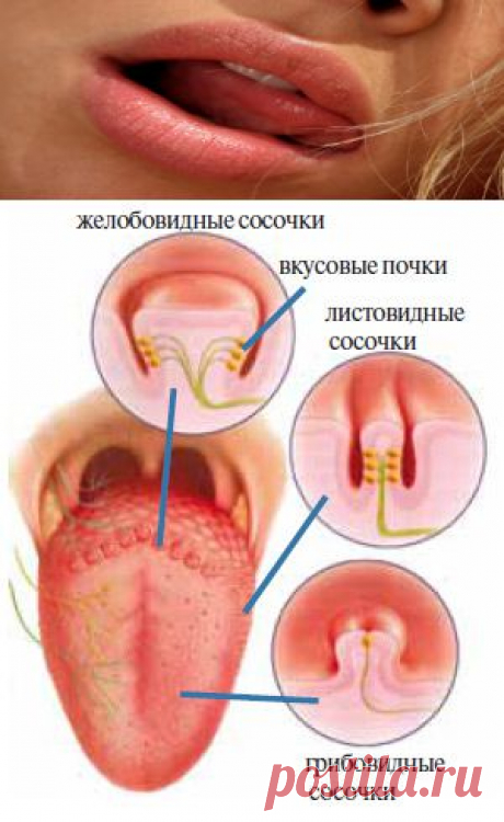 Диагностика болезней по языку