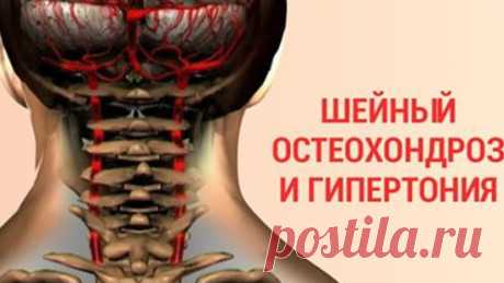 Мало кто поверит в тот факт, что шейный остеохондроз может быть намного опаснее онкологических заболеваний. Но тем не менее это так! Многочисленные пациенты врача-реабилитолога Александра Шишонина утверждают, что лучше правильно крутить шеей, чем всю жизнь страдать от гипертонии и бояться внезапного наступления инфаркта или инсульта.
Упражнения при шейном остеохондрозе
Шишонин убежден, что именно шейный остеохондроз становится первопричиной гипертонии, и лишь в 5 % случаев...