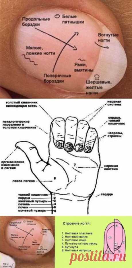 Диагностика по ногтям в восточной медицине | ВСЕГДА В ФОРМЕ!