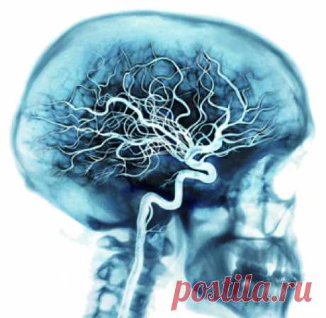 Как почистить сосуды головного мозга народными средствами
