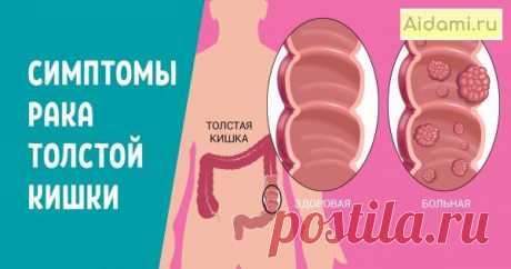 5 тревожных признаков рака толстой кишки. При первом дискомфорте в ЭТОЙ области спеши на обследование! | АйДаМы | У нас Всегда лучшее