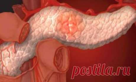 Применяй 4 действенных народных рецепта! Поджелудочная железа – орган, который имеет очень...