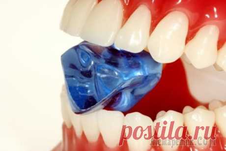 Причины появления и вред зубного камня для человека
