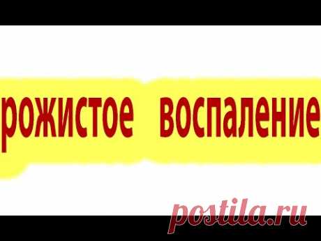 Как вылечить рожистое воспаление. Осложнения рожи.Схема лечения#малиновский