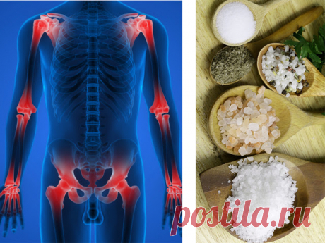 Солевые повязки лечат практически все - Жизнь планеты