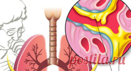 Как вывести слизь из лёгких и облегчить дыхание / Будьте здоровы