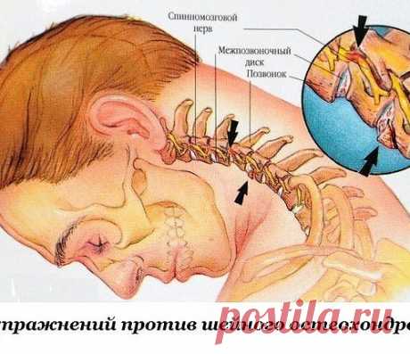 Восемь упражнений против шейного остеохондроза