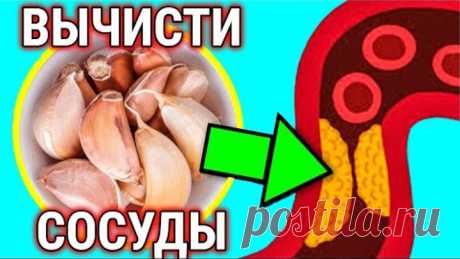 СОСУДЫ Как в МОЛОДОСТИ! Эликсир МОЛОДСТИ! Рецепт ДОЛГОЛЕТИЯ!