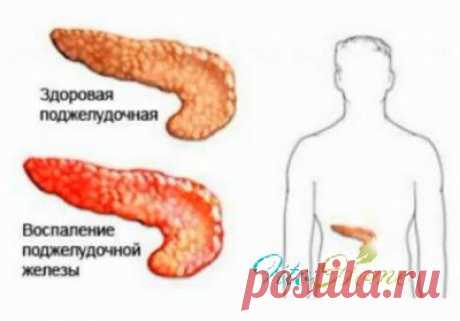 Панкреатит: лечение народными средствами