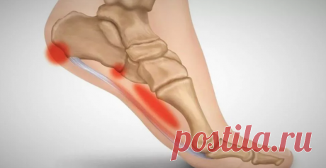 3 упражнения от боли в пятках от доктора Евдокименко. Избавляемся от пяточной шпоры | Просто о здоровье | Яндекс Дзен