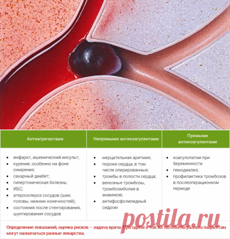 Нужно ли специально разжижать кровь? Рассказывает врач кардиолог | Врачи и пациенты | Яндекс Дзен