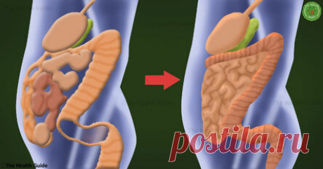 Как избавиться от 15 кг токсинов, отложенных в вашей толстой кишке, с помощью всего 2 ингредиентов! Стоит попробовать! Ничего сложного! Толстая кишка является одним из наиболее важных органов в организме, потому что она регулирует иммунную систему, помогает процессу пищеварения и поддерживает водный баланс в организме. Поэтому, когда толстая кишка не функционирует на 100%, токсичные отходы начинают накапливаться в организме. За период всей нашей жизни более 30 000 литров ж...