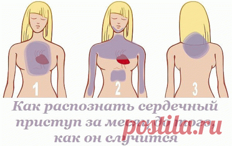 (38) Однокласники