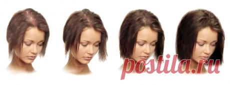 Сильно выпадают волосы? Простой рецепт решит проблему! — Journal women❜s