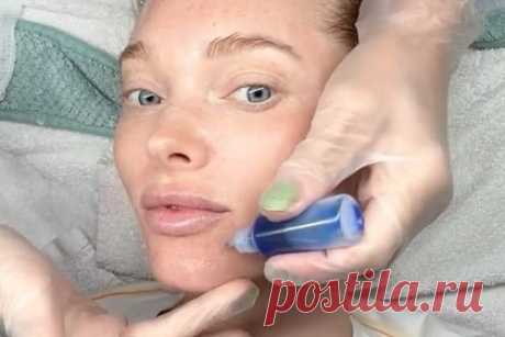 Бывший «ангел» Victoria's Secret показала лицо без макияжа в кабинете у косметолога