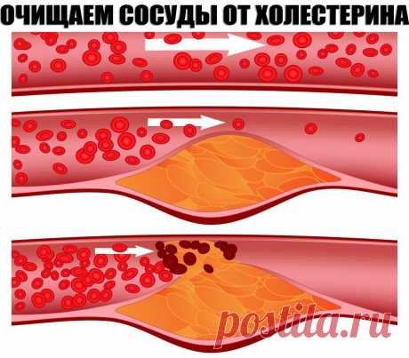 (1) Одноклассники