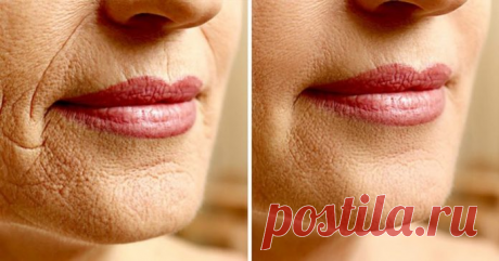 15 доказанных наукой средств для минимизации морщин