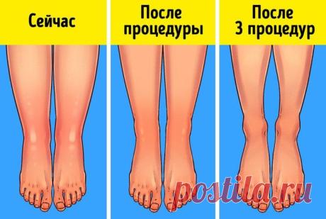 Способы применения пищевой соды, о которых мало кто знает | В темпі життя Мы расскажем о новых способах применения пищевой соды, о которых многие даже не догадываются, а вы уже сегодня можете их испытать.