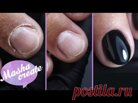 Маникюр. Сложные руки + наращивание без форм акригелем. Аппаратный маникюр: тонкая налипшая кутикула