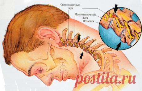 ПРИ БОЛЯХ В ШЕЕ И ПЛЕЧАХ...
