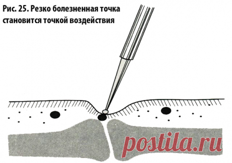 😉: СУ ДЖОК СЕМЯНОТЕРАПИЯ * ПРИНЦИПЫ ПРИМЕНЕНИЯ
СЕМЯН РАСТЕНИЙ