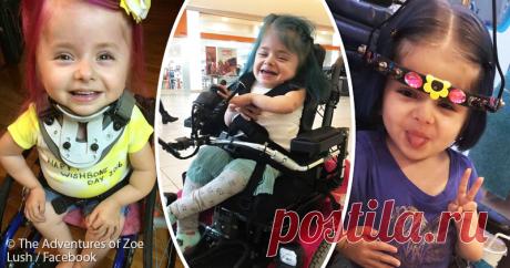 Кости девочки ломаются даже при дуновении ветра. Но благодаря невероятной силе воли она пошла! | Краше Всех